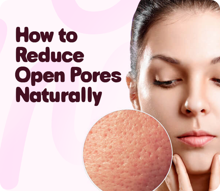 How to Reduce Open Pores Naturally