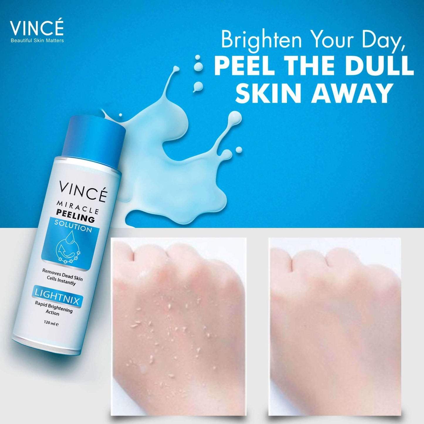 Vince - Miracle Peeling Solution - 120ml