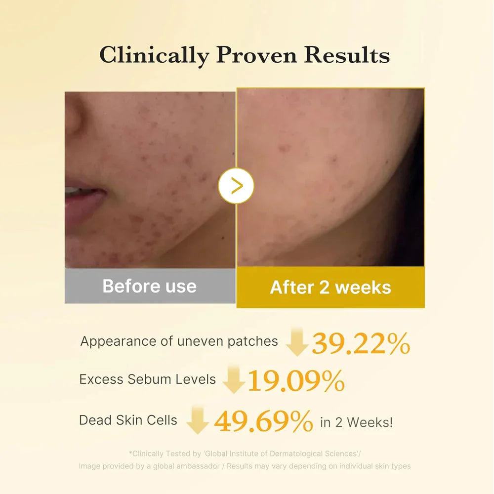 Medicube - Kojic Acid Turmeric Pad (70 Pads) - 160ml