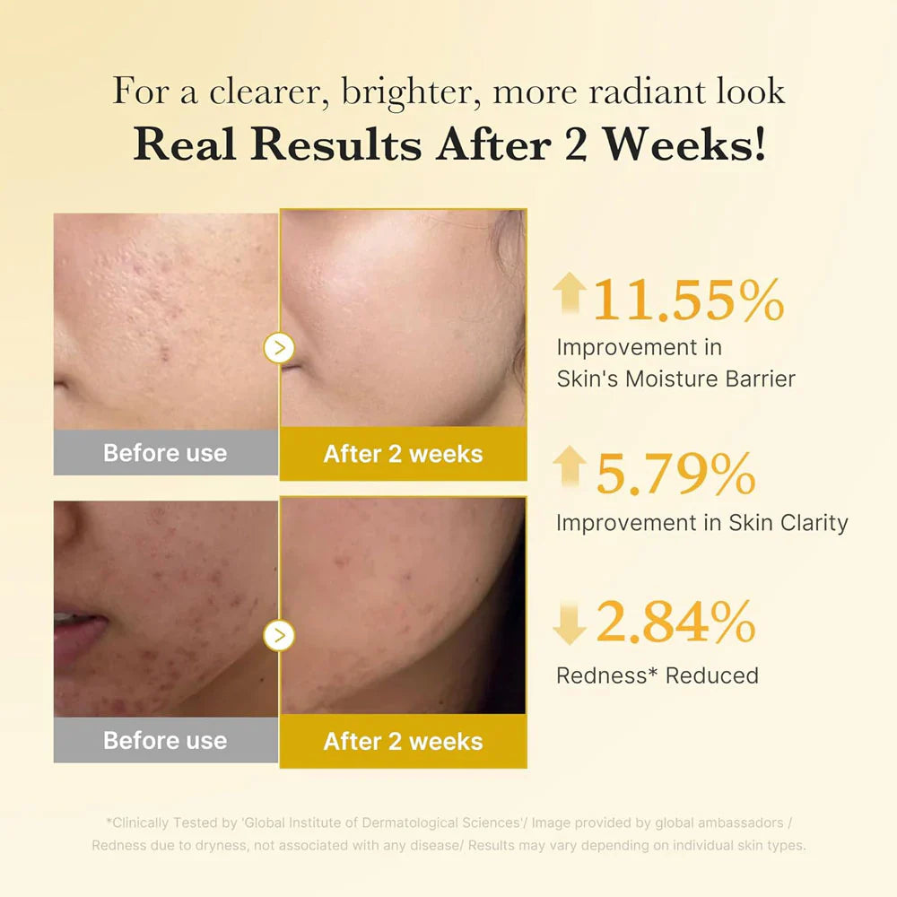 Medicube - Kojic Acid Turmeric Niacinamide Serum 30ml