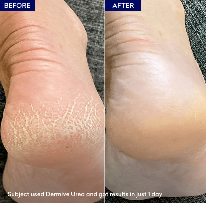 Jenpharm Dermive Urea Hydrating Healing Lotion 100Ml