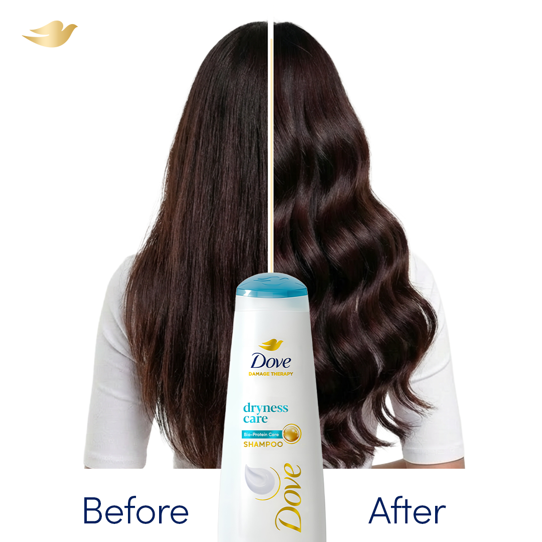 Bundle - Pack of 2 Dove Shampoo Dryness Care - 175Ml