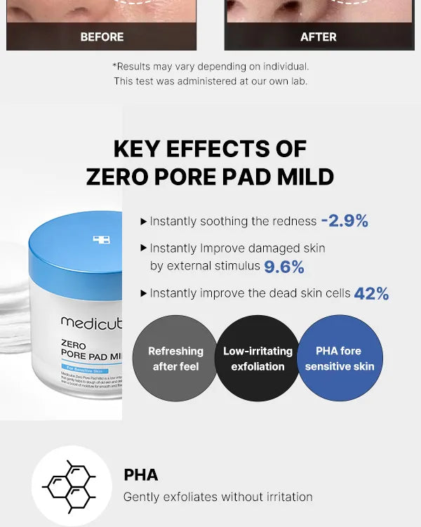 Medicube - Zero Pore Pad Mild - 155G