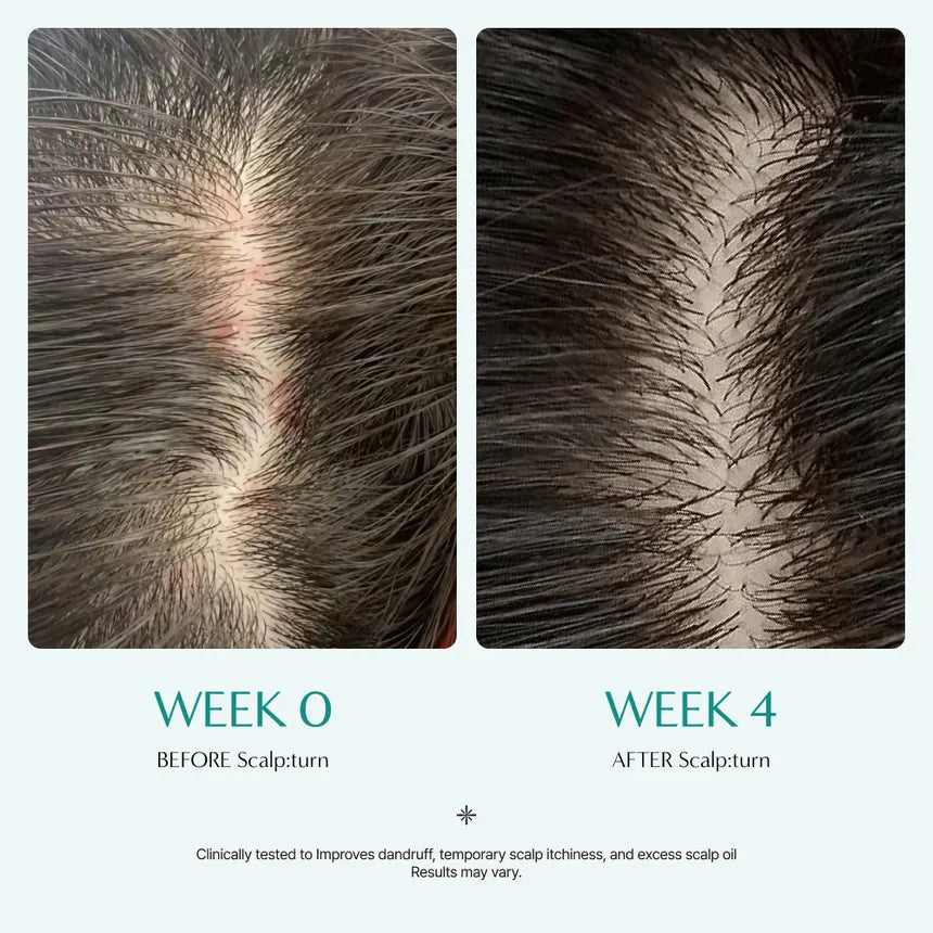 Lilyeve - Scalp Turn Cica PDRN Brush Ampoule Mini - 30ml