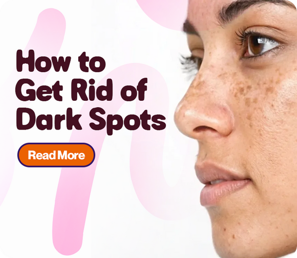 How to Get Rid of Dark Spots