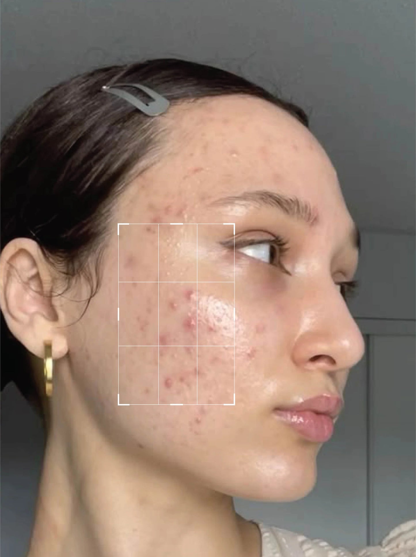 Beautenic - Oil Control Facewash Tea Tree Oil+ Salicylic Acid