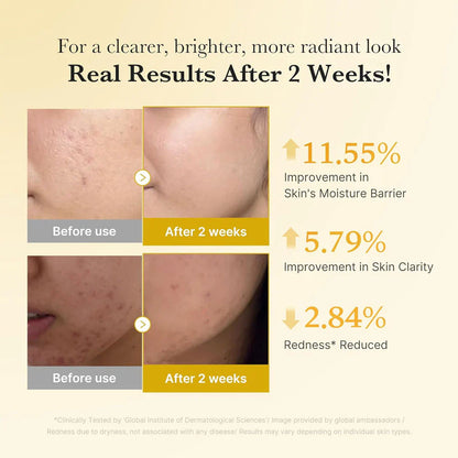 Medicube - Kojic Acid Turmeric Niacinamide Serum 30ml