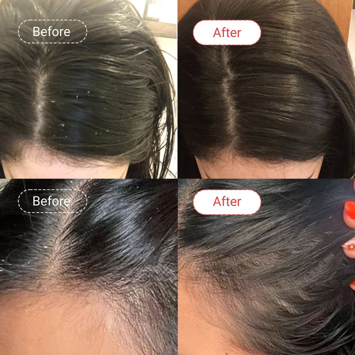 Before / After results of users of AccuFix