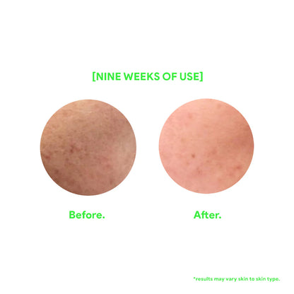 Fused Sunscreen Spray SPF 50 (50ml)