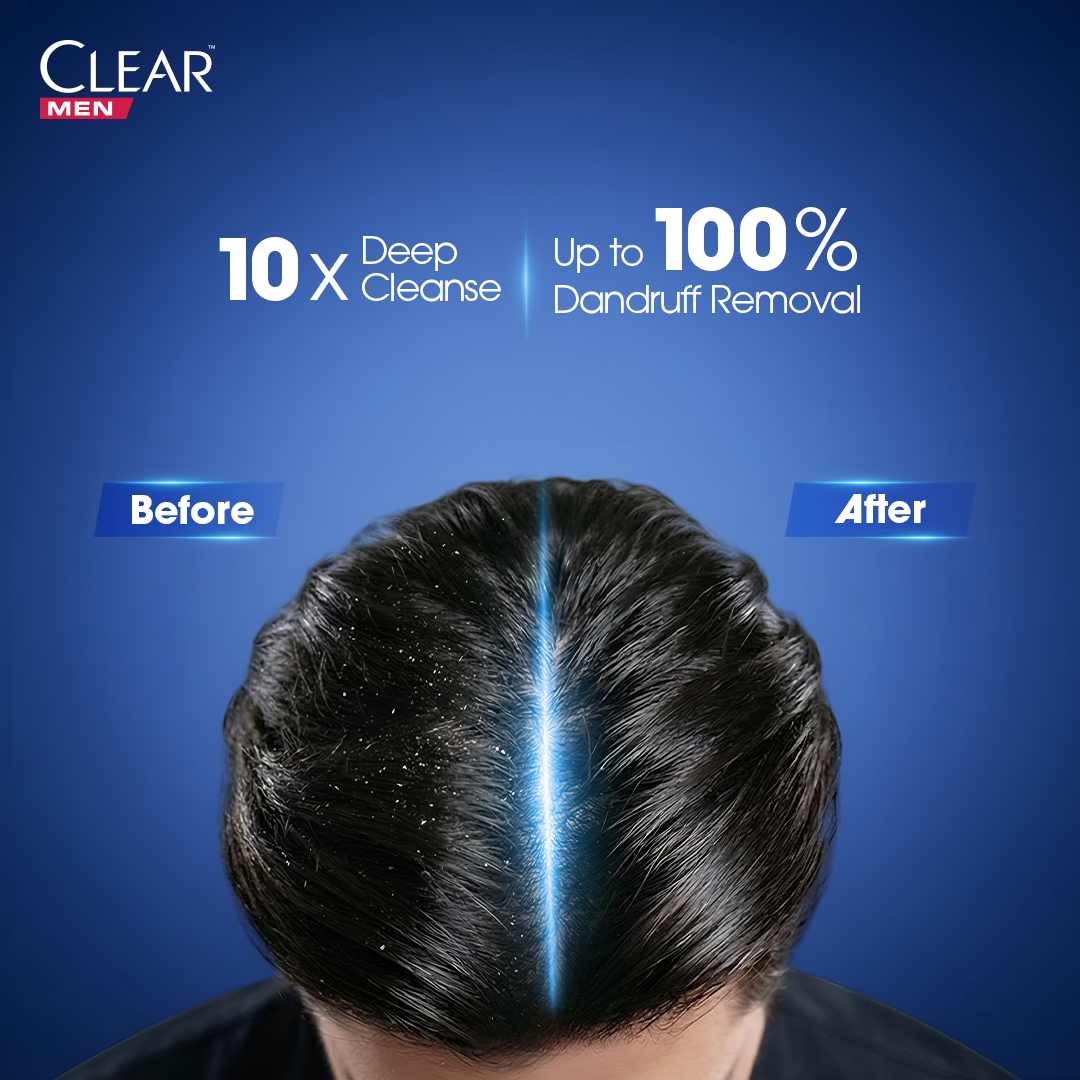 Clear - Deep Cleanse Shampoo - 200ml