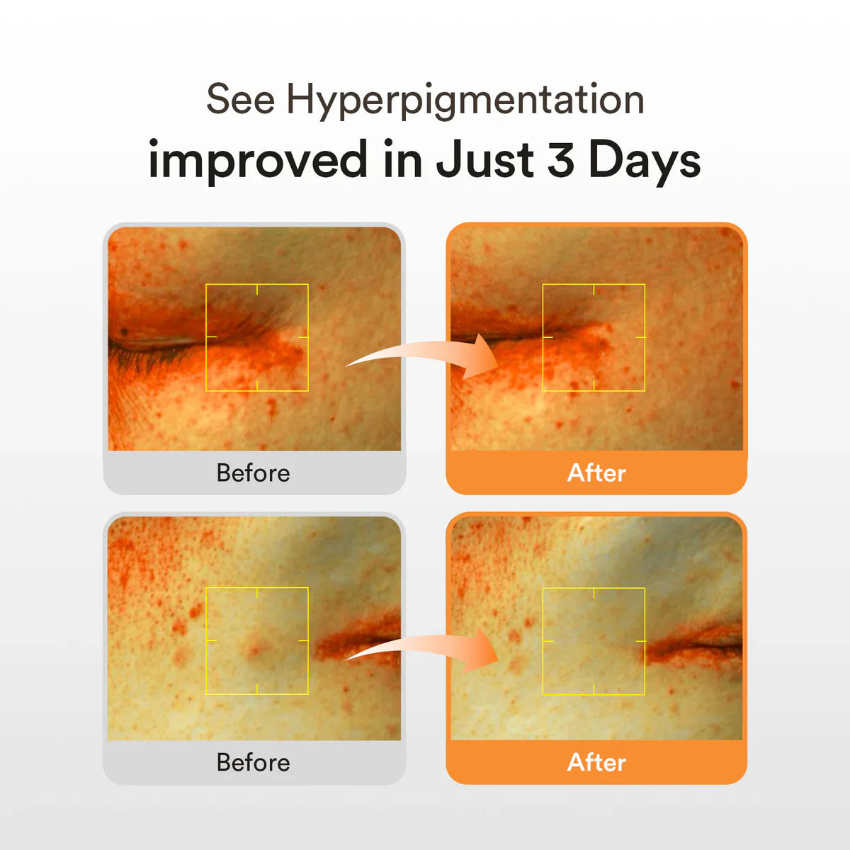 Abib - Glutathiosome Dark Spot Serum Vita Drop 50ml