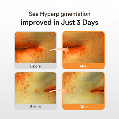 Abib - Glutathiosome Dark Spot Serum Vita Drop 50ml