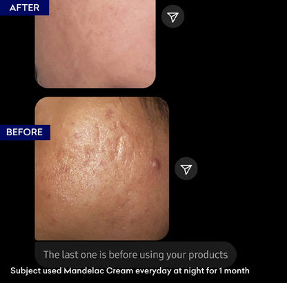 Jenpharm Mandelac Double Action Night Cream 30G