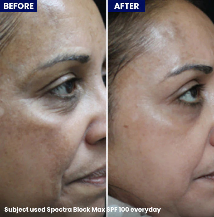 Jenpharm Spectra Block Broad Spectrum Sun Block Cream 40G