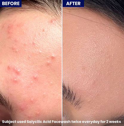 Jenpharm - Salicylic Acid Face Wash