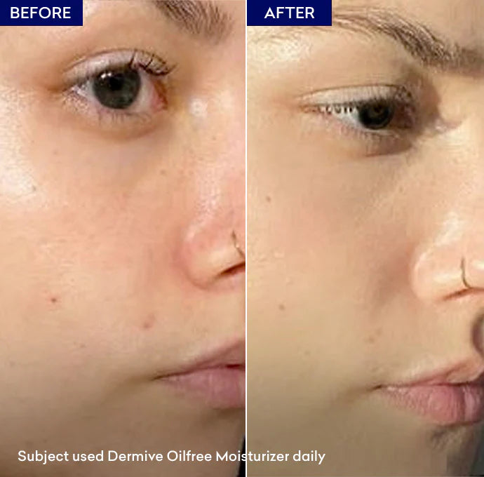 Jenpharm Dermive Oil Free Moisturizer Lotion 100Ml