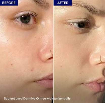 Jenpharm Dermive Oil Free Moisturizer Lotion 100Ml