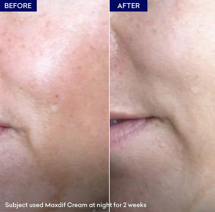 Jenpharm Maxdifskin Brightening Cream Maximum Difference 40G