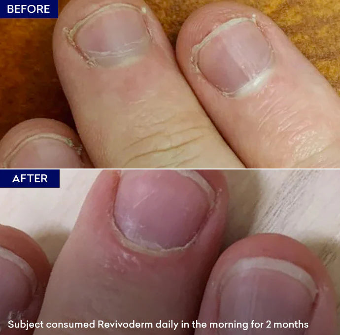 Jenpharm Revivoderm Nutritional Supplement 20S - Shopify Requirment