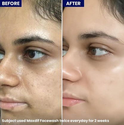 Jenpharm Maxdif Brightening Gel Face Wash 100Ml