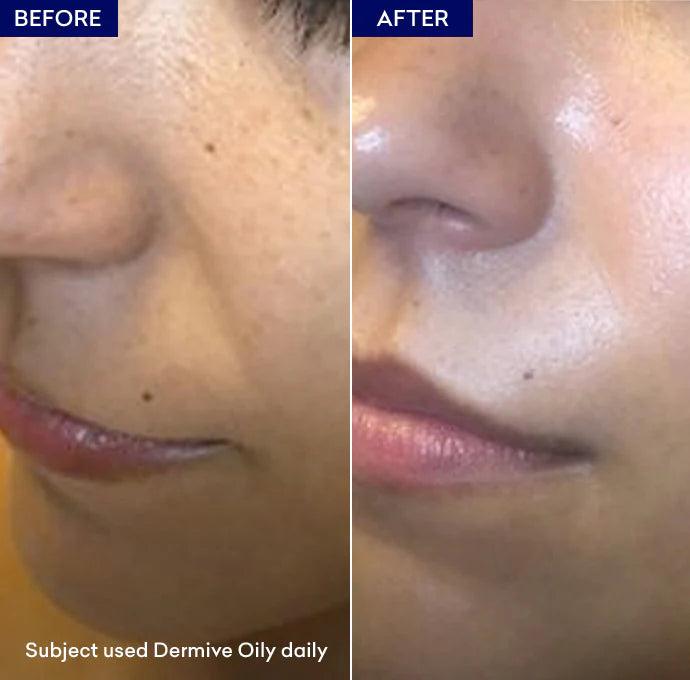 Jenpharm DermiVe Oily Moisturizer Lotion 100Ml