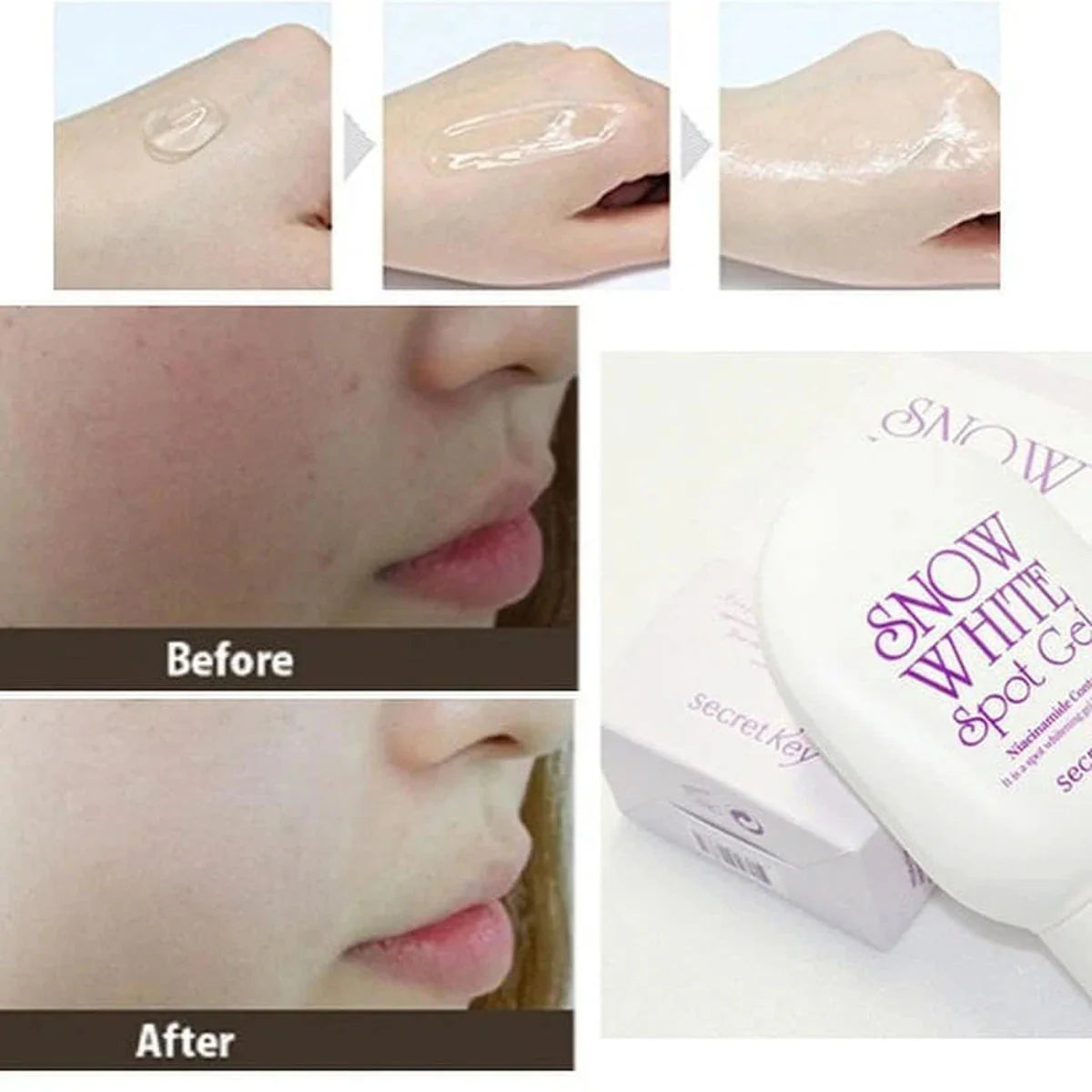 Secret Key - Snow White Spot Gel - 65g