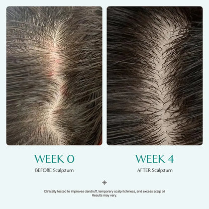 Lilyeve - Scalp Turn Cica PDRN Brush Ampoule Mini - 30ml