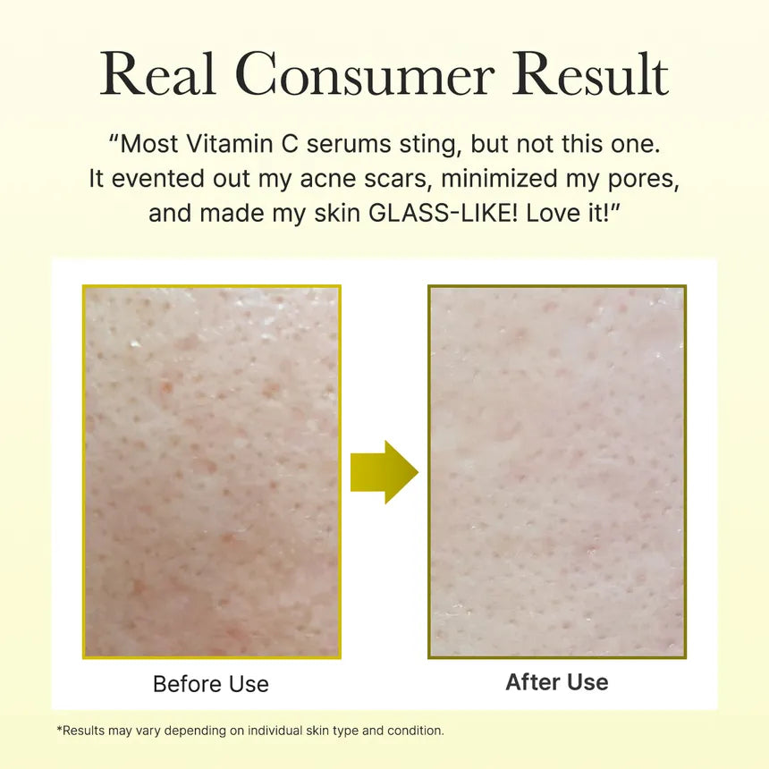 Arencia - Face & Eye Moisturizer Cream Vitamin C Booster Shot - 10Ml