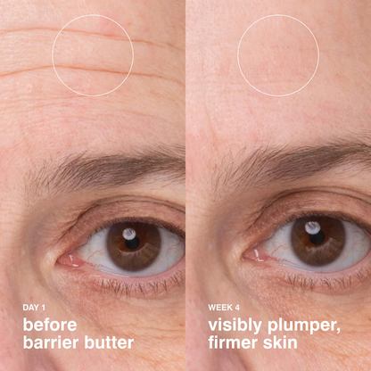 Rhode - Barrier Butter - 40ml