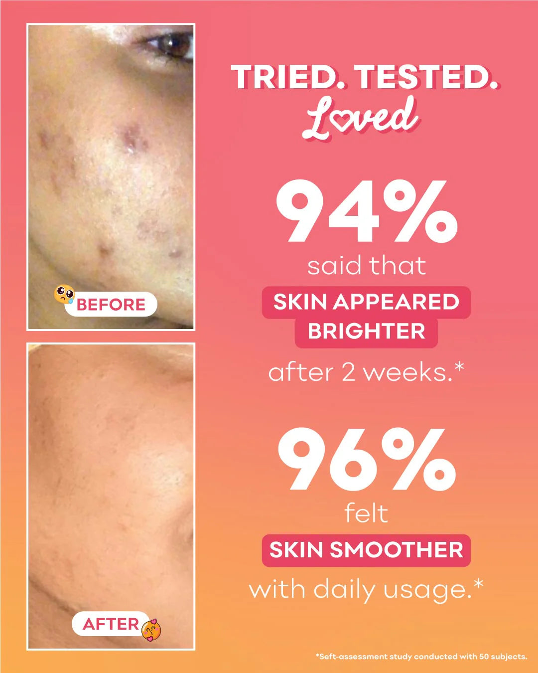 Nirvana Botanics - Peachcinamide TXA Serum (6% Niacinamide, 4% TXA)