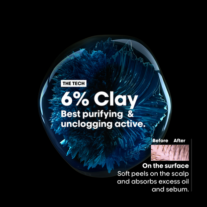 L'Oreal Professional - Serie Expert Scalp Advance Shampoo 300 ML - For Oily Scalp