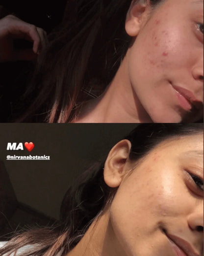 Nirvana Botanics - Cloud - Oil Free Gel Moisturizer