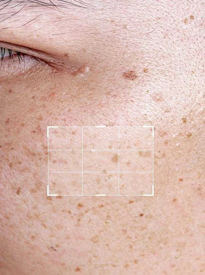 Beautenic - Glycolic Acid 7% Serum