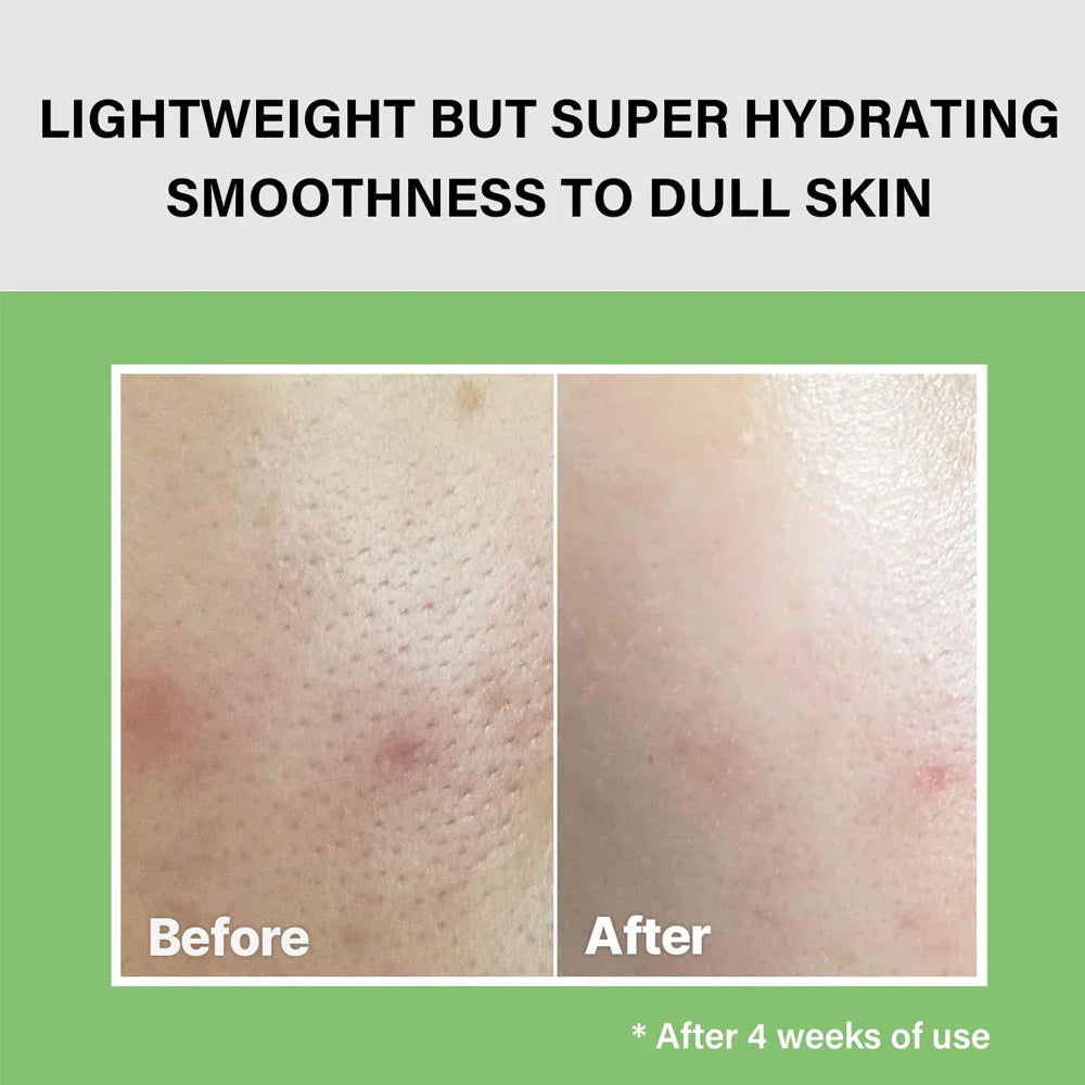 Celimax - The Real Noni Moisture Balancing Toner 150ml