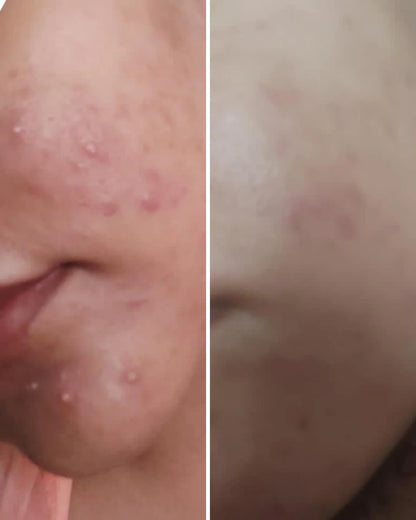 Nirvana Botanics - Vitamin C & E Serum