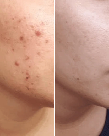 Nirvana Botanics - Vitamin C & E Serum