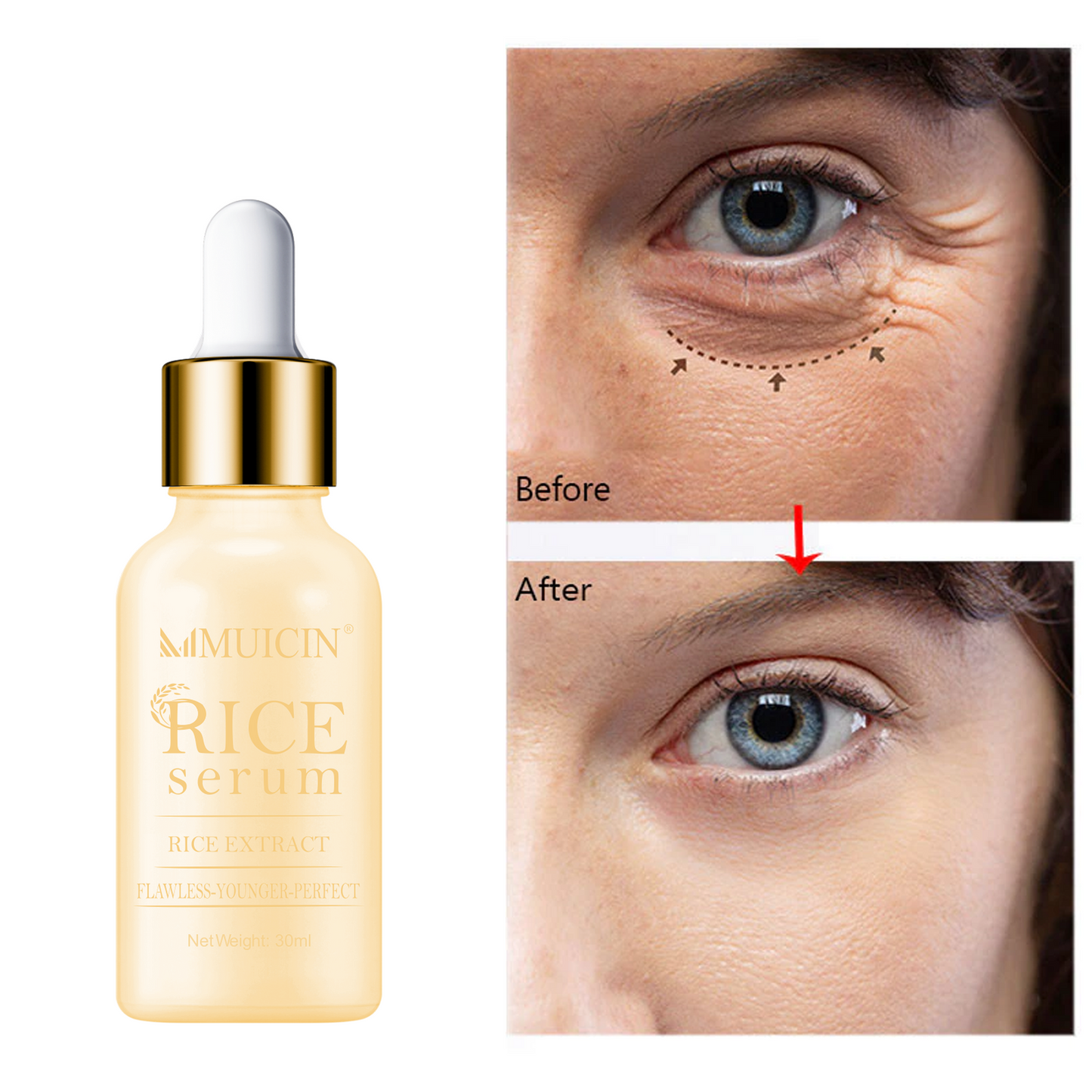 MUICIN - Rice Serum For Fairer & Flawless Skin